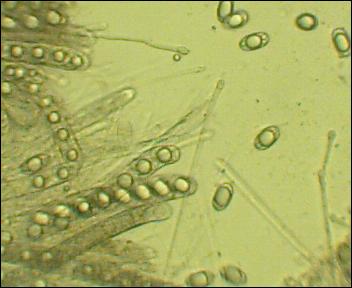 microscopio